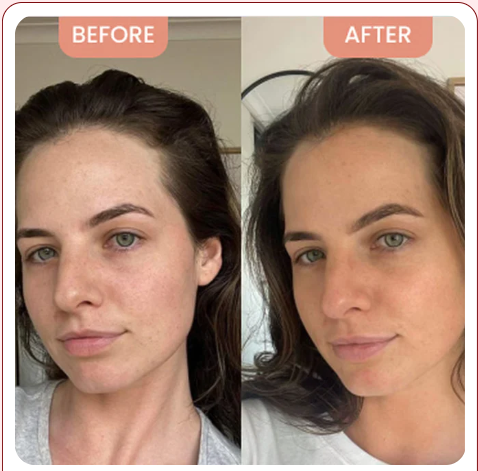 <h1><strong>The Glow Everyone Is Talking About</strong></h1>