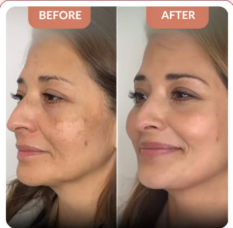 <h1><strong>The Glow Everyone Is Talking About</strong></h1>