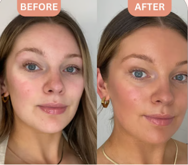 <h1><strong>The Glow Everyone Is Talking About</strong></h1>